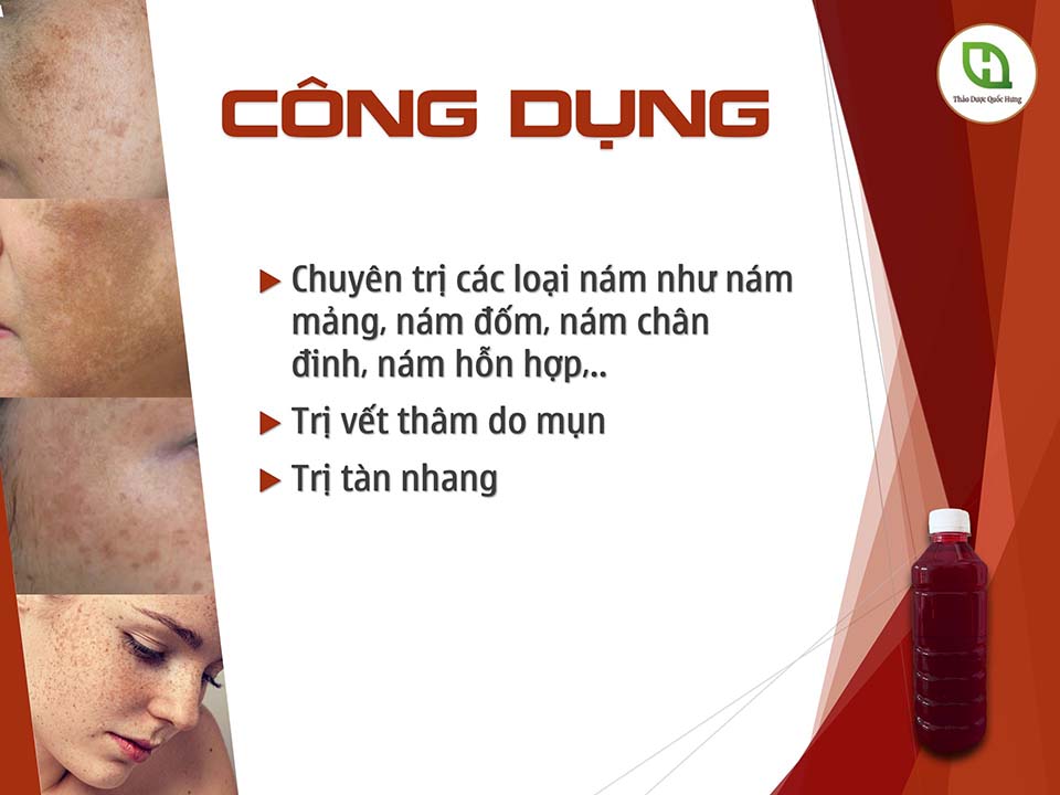 Thuốc bắc - đông y tái tạo da cao cấp huyết sâm chuyên trị nám - Ảnh 3
